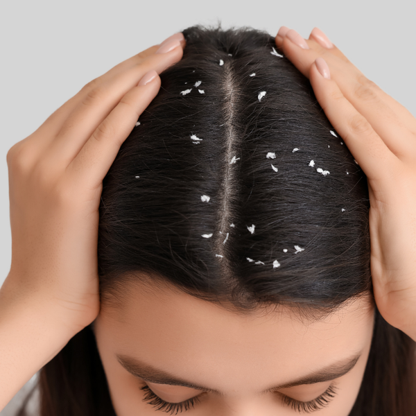 Dry and flaky scalp